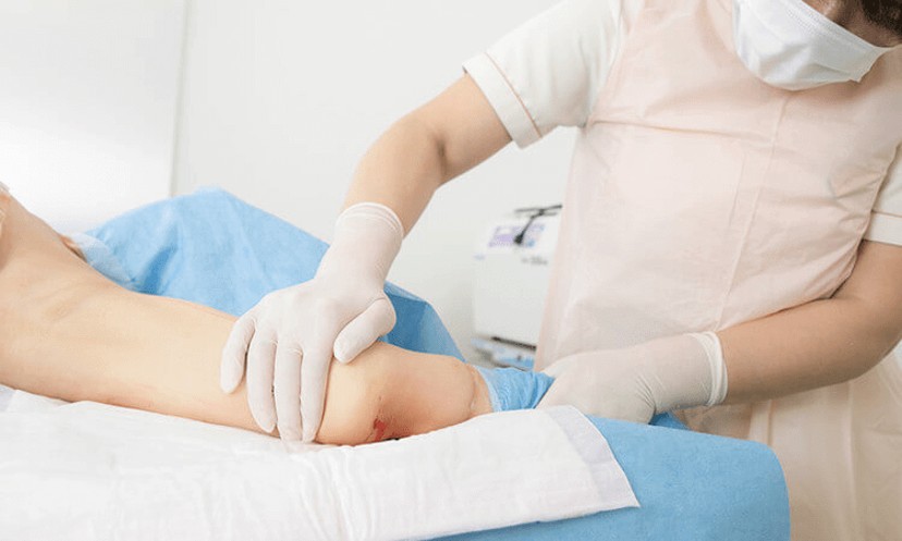 麻酔液の絞り出しの画像