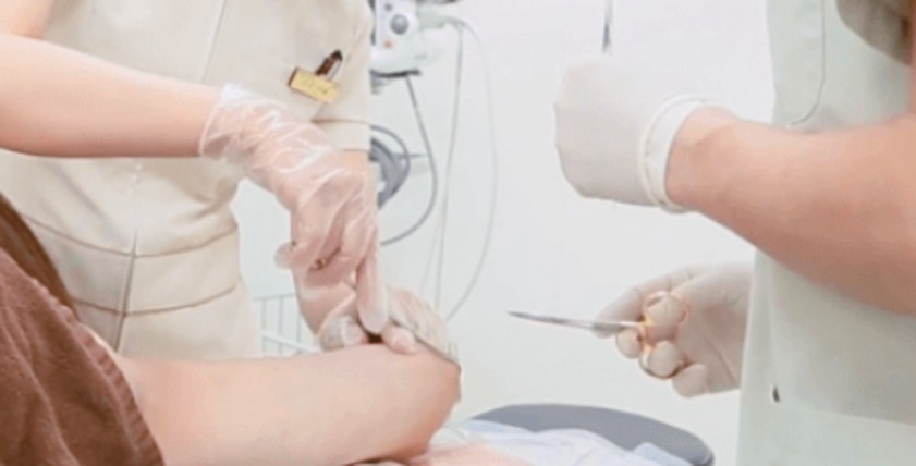 傷口の翌日縫合の画像